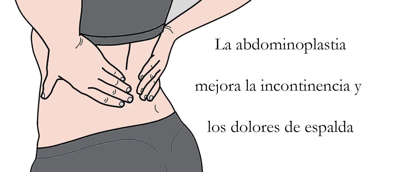 La abdominoplastia mejora la incontinencia y los dolores de espalda